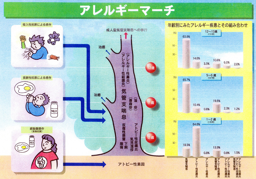 アレルギーマーチ